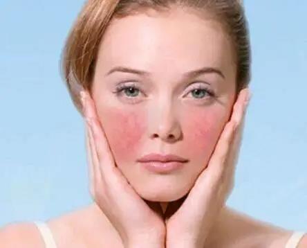 春季皮肤干燥,发痒,过敏问题不断,孕妈该如何是好?